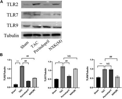 A Simplified Herbal Formula Improves Cardiac Function and Reduces Inflammation in Mice Through the TLR-Mediated NF-κB Signaling Pathway